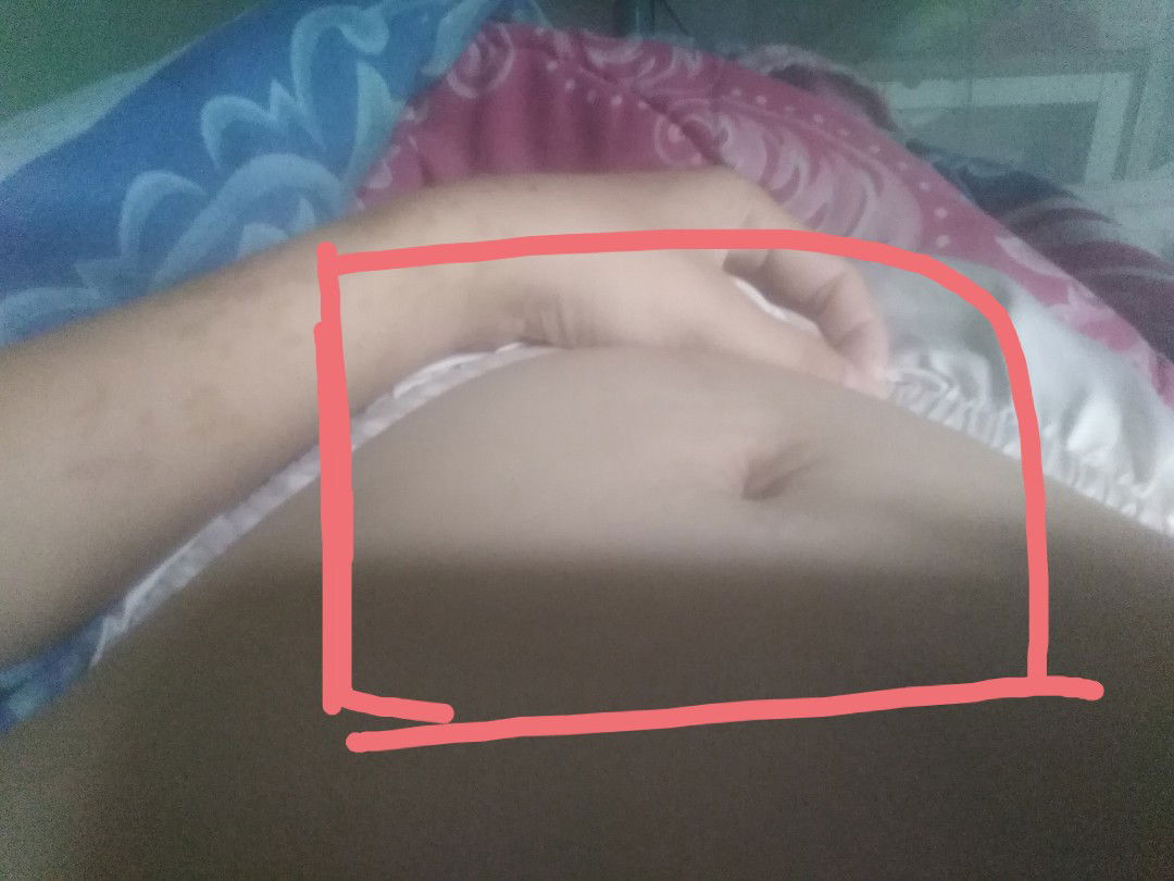 ใช้ตัวเล็กไหมค่ะ​ 10​ สัปดาห์​ 3​ วัน