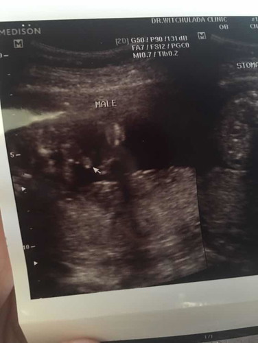 แม่ๆช่วยดูหน่อยผู้ชายไหมค่ะ