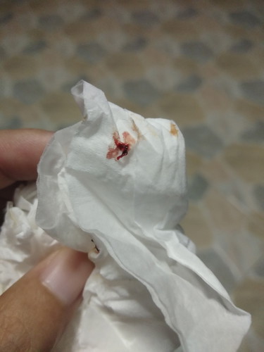 ตั้งครรภ์7สัปดาห์ มีเลือดออกนิดๆ