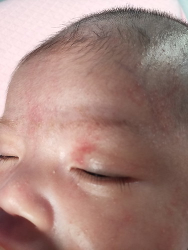 ใช่ปานหรือเปล่าคะ