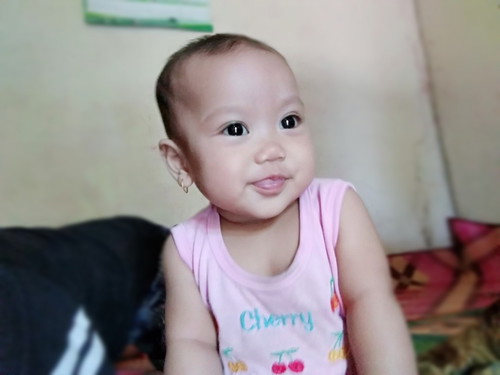 Masalah pada rambut