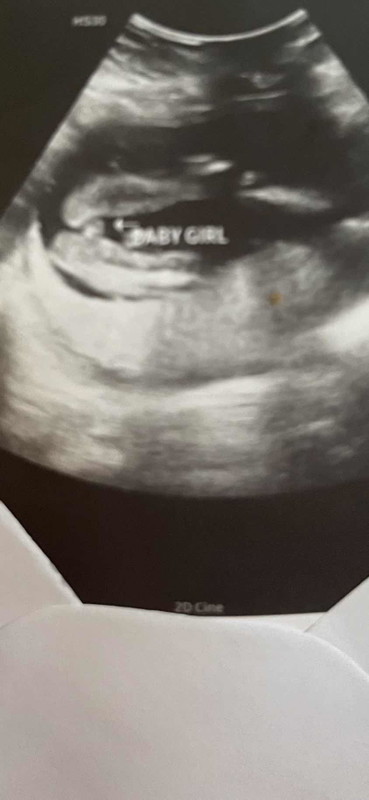 20 weeks Girl
