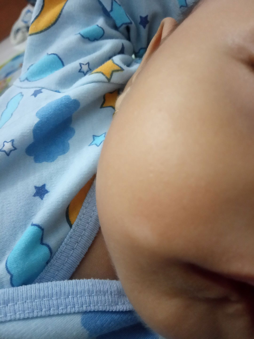 bercak putih di pipi