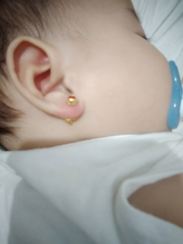 ano po kaya pdeng remedy sa ears ng baby girl ko..