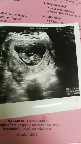 Ibu Yg Excited... 11 Week