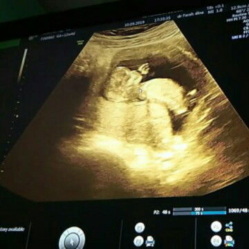 Tes Laboratorium atu tidak?