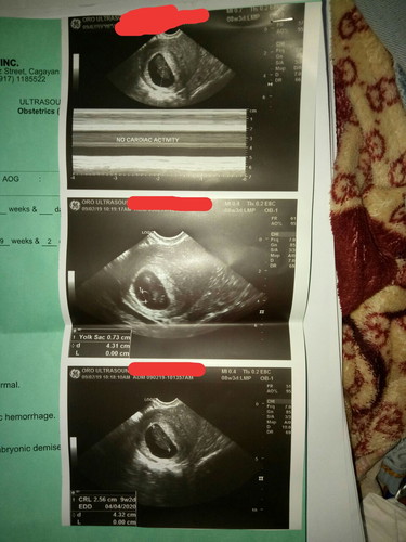 NO HEARTBEAT..????