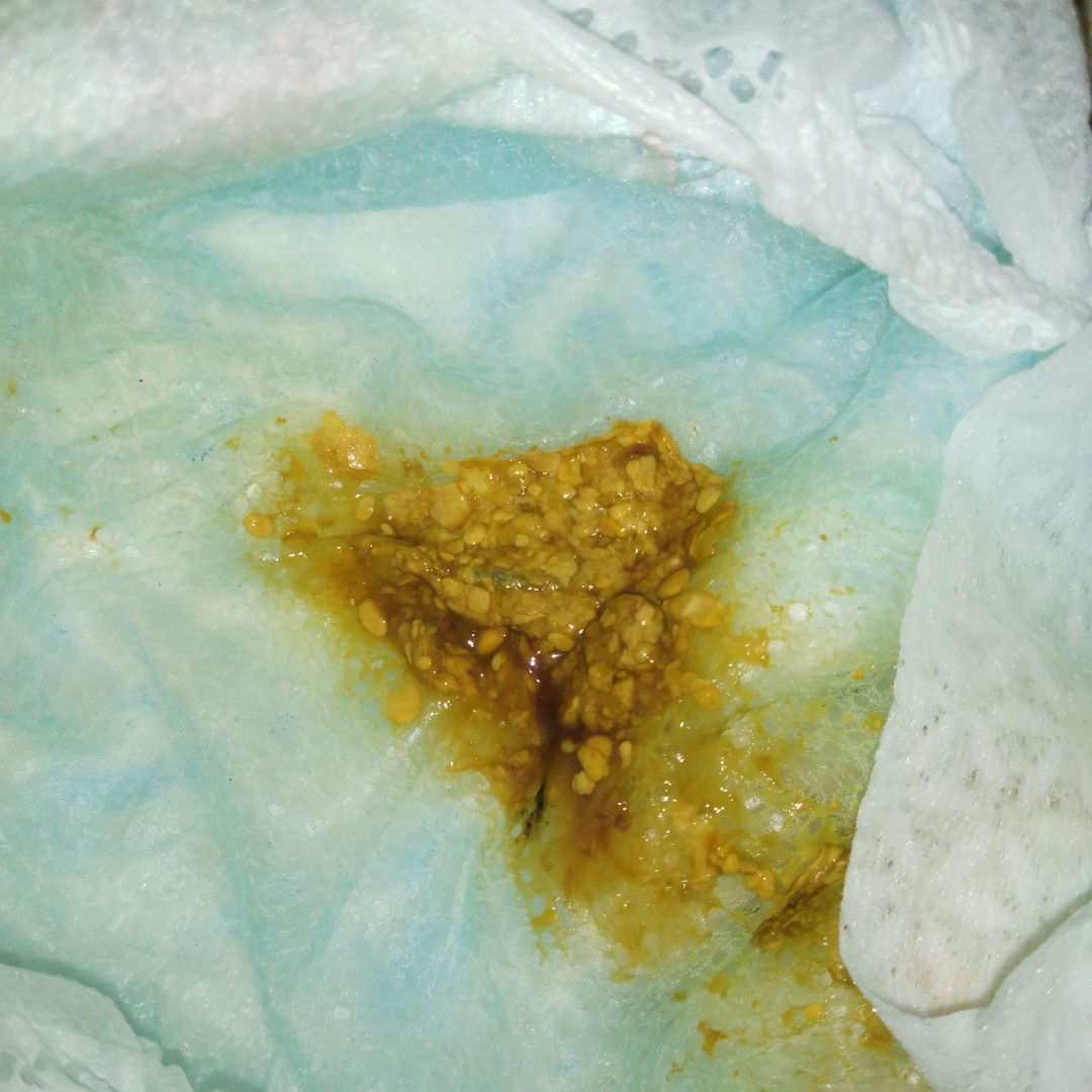 My baby's poop