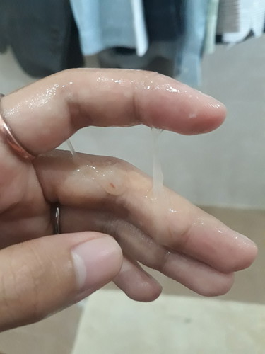 38+2แบบนี้คืออะไรค่ะ มีเลือดนิดหน่อย