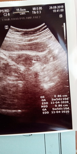 USG BEDA DOKTER HASILNYA BEDA BIKIN BINGUNG