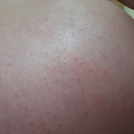 ตั้งครรภ์