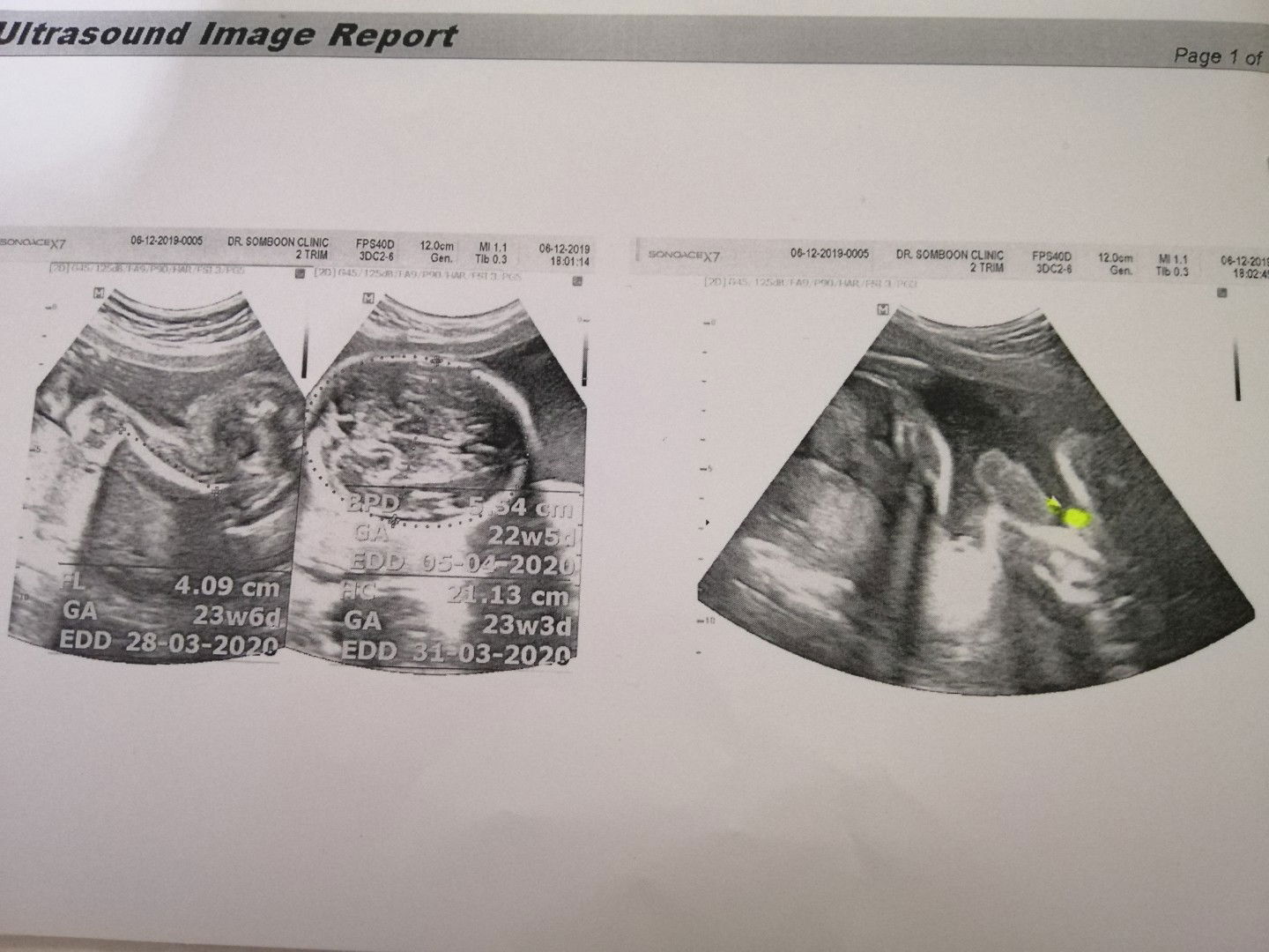 ขอสอบถามค่ะ