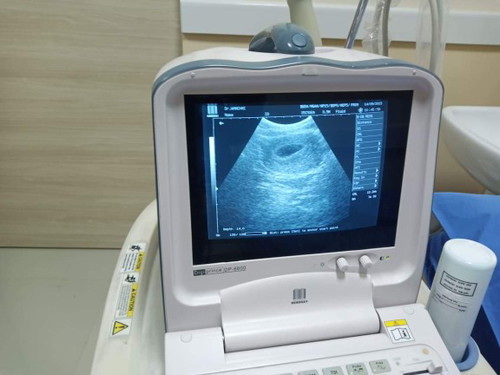 สงสัย