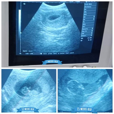 รักแรกพบ