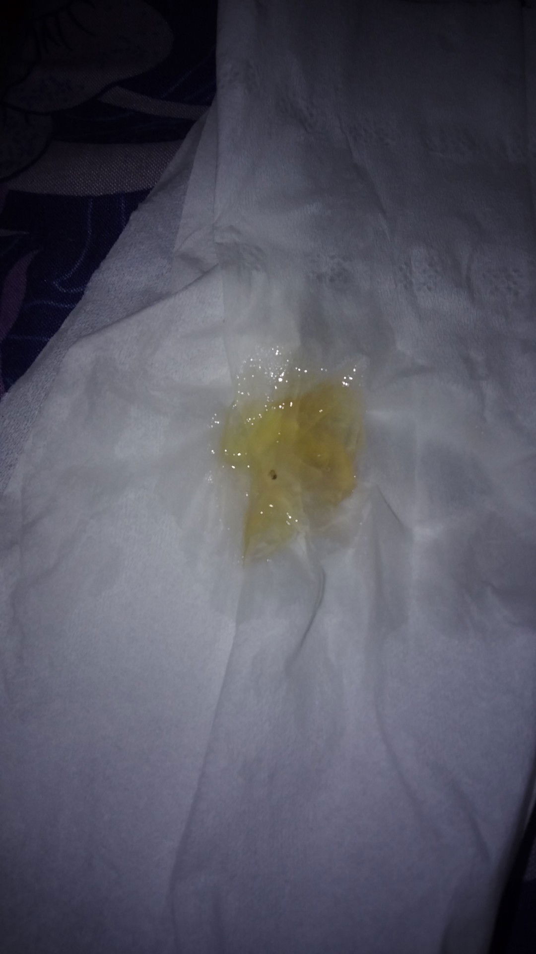 keluar lendir coklat