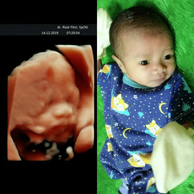 Ummi Ariyani profile icon