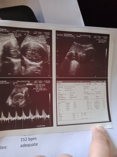 its a boy !