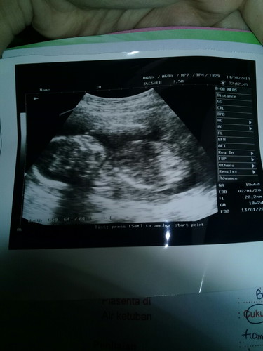 20week