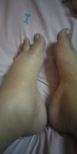 เท้าบวมมาก