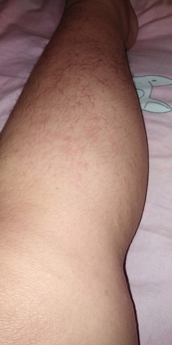 37 สัปดาห์ 2 วัน