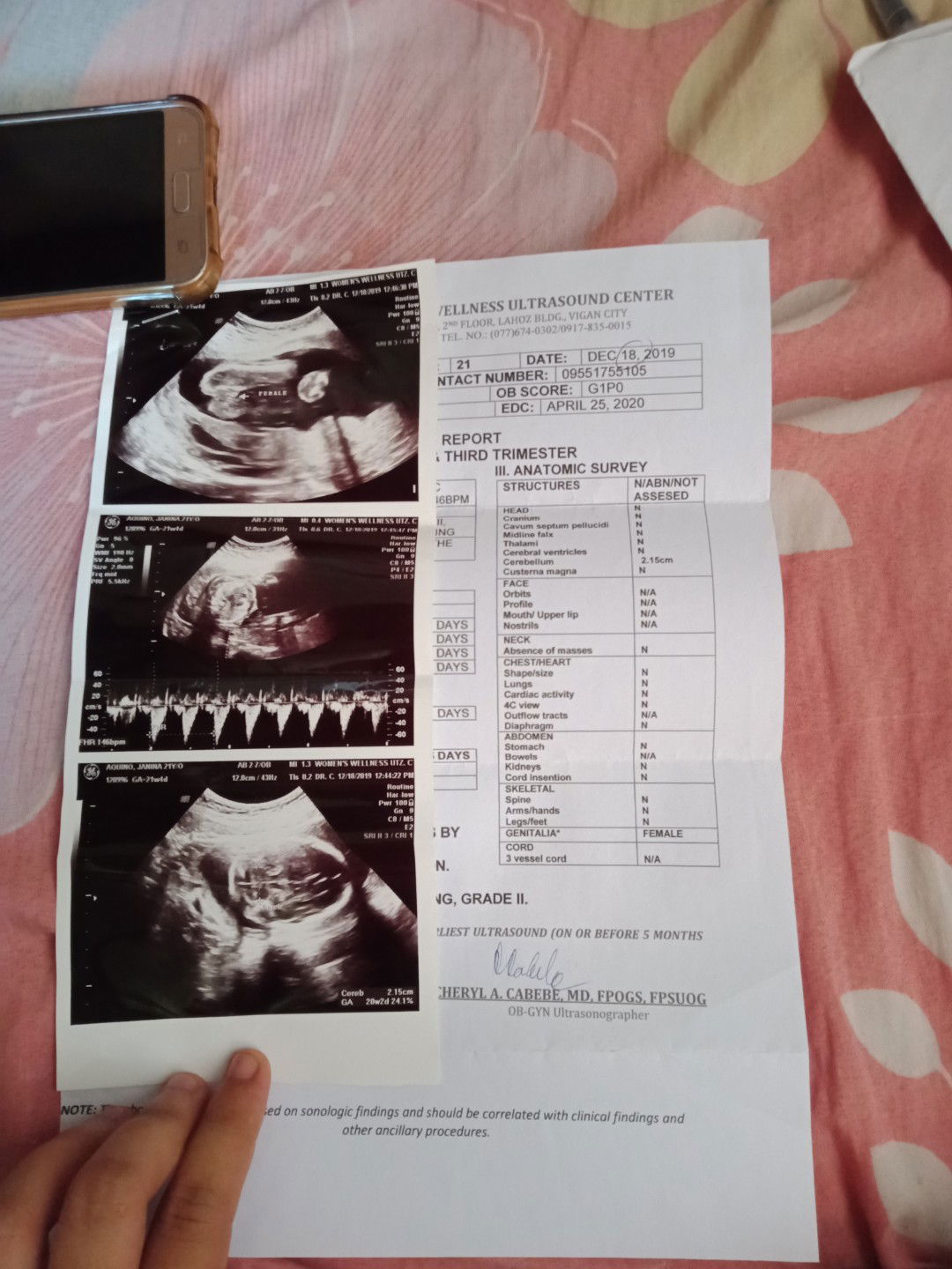 Baby girl or baby boy?