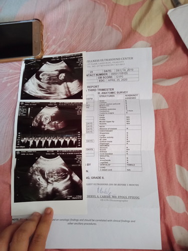 Baby girl or baby boy?