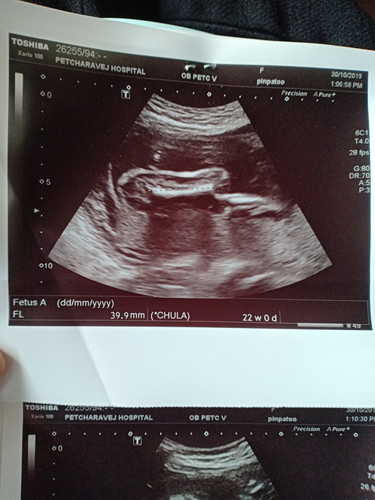 อันนี้คือส่วนไหนคะแม่ๆ