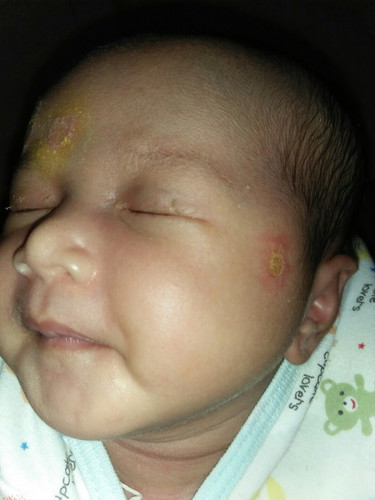bayi