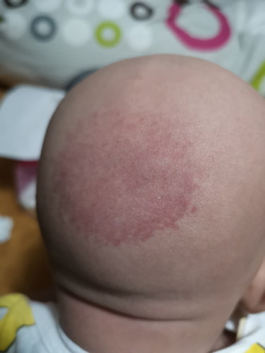 สอบถามค่ะ