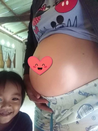 อาการปวดหลังของแม่ๆ