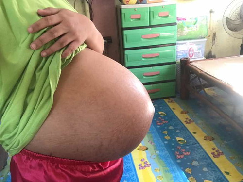 36weeks na ko bukas