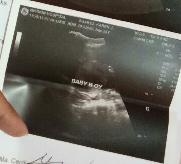 baby boy or girl
