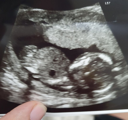 nakaharap or nakatalikod?