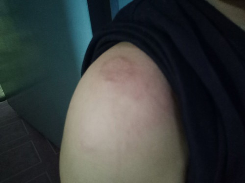 แม่ท่านไหนเคยมีอาการแบบนี้บ้างค่ะ