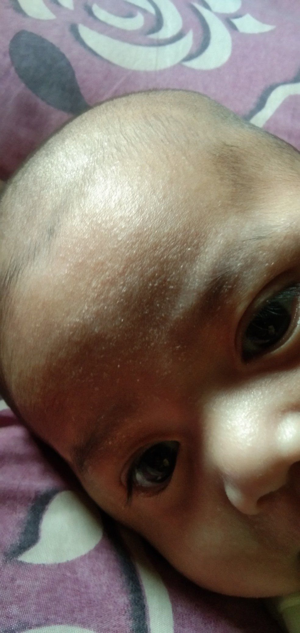 Masalah Kulit