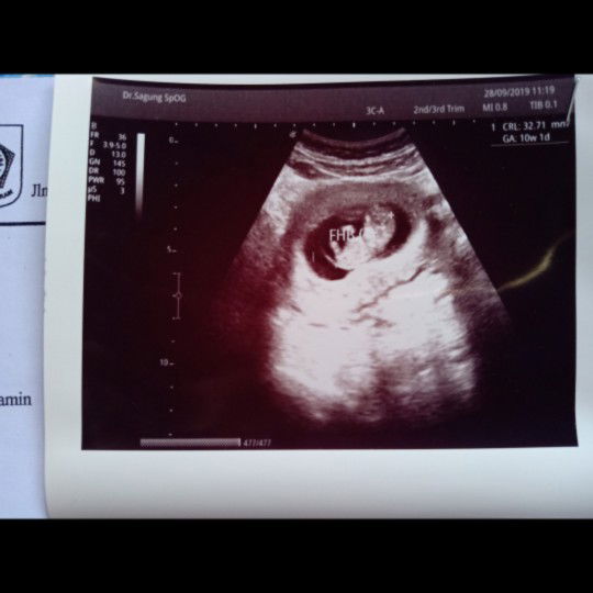 perut belum kelihatan buncit.