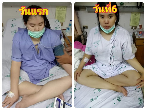 ใครที่ตั้งครรภ์และเกิดภาวะโรคแทรกซ้อนจากการตั้งครรภ์บ้่างค่ะ