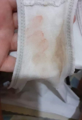 Brown and Red Discharged !