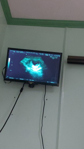 8weeks preggy. Hello there baby ko iloveyouuu