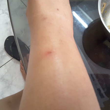 di gigit kutu kucing