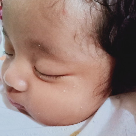butlig sa mukha