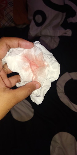 Nge flek apa kah tanda kehamilan kosong?