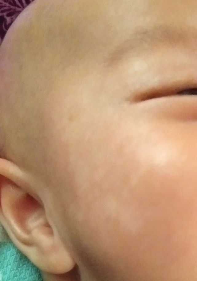 pipi ada plek putihnya