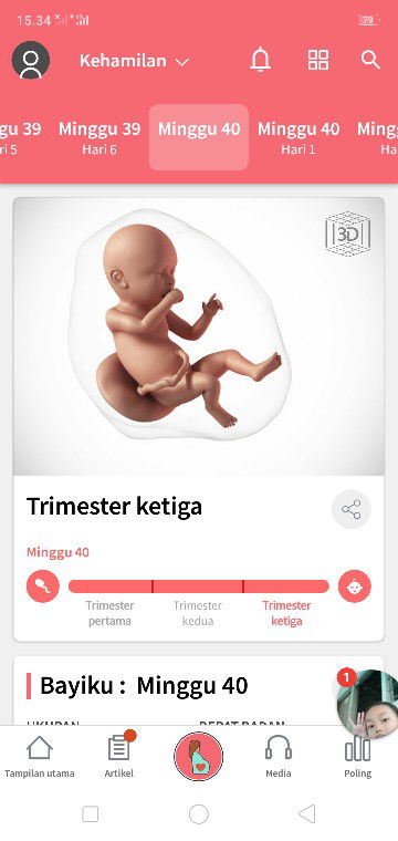 kepala bayi dangak