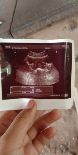 16w