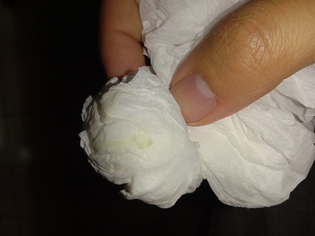 ตกขาวหรือป่าวค้ะ