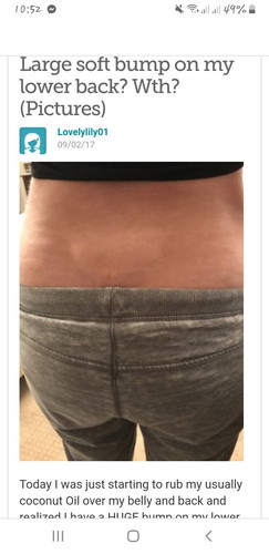 bump in lower back