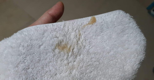 mucus plug na to?