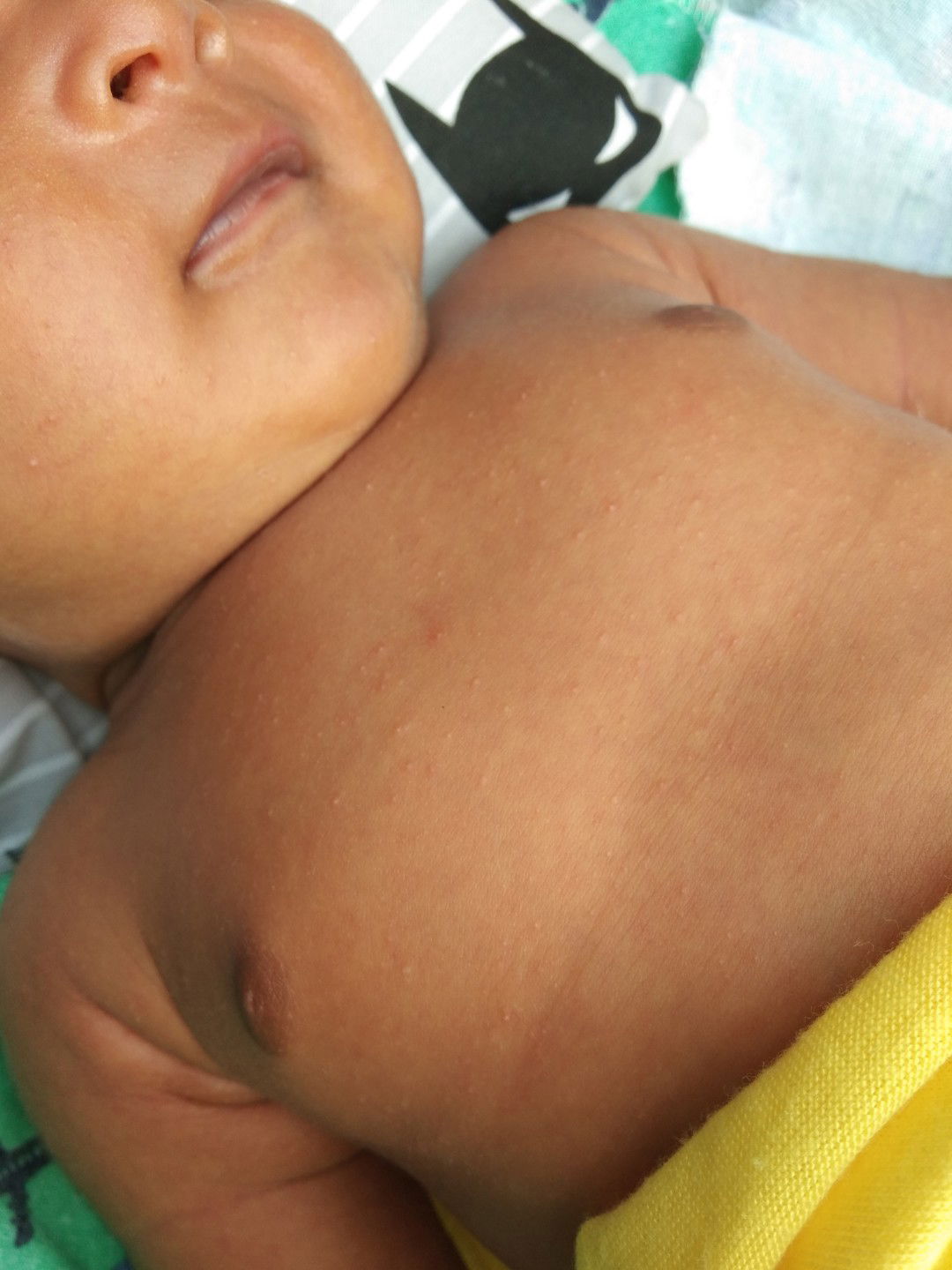 OBAT BERUNTUSAN BAYI ?