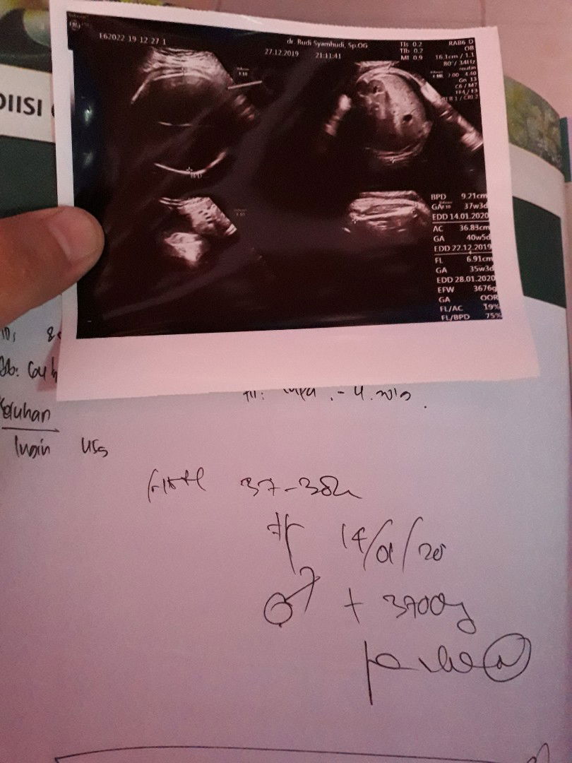 ada yang ngalamin gak?